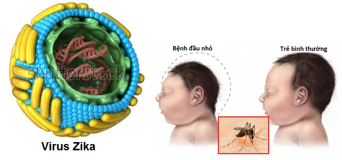 Virut Zika và biểu hiện bệnh ở người
